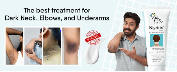 The best treatment for dark neck, elbows, and underarms!